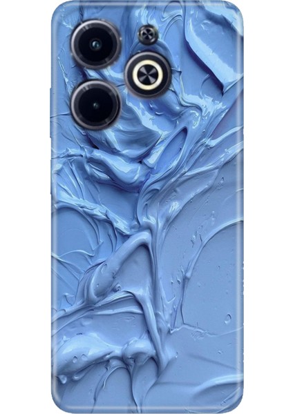 Infinix Hot 40 Kılıf Desenli Baskılı Tpu Rubber Kapak Sanatsal