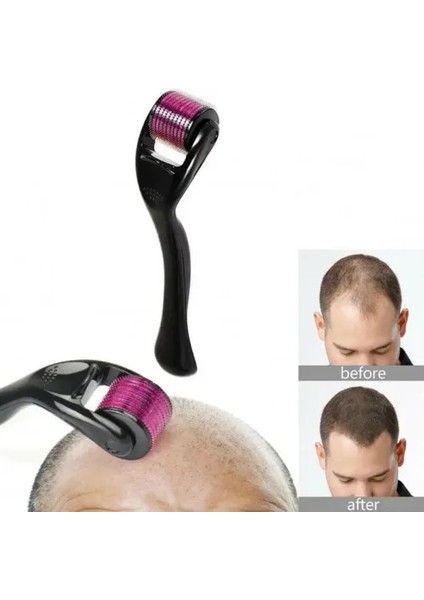 Derma Roller Titanyum Iğneli Cilt Bakım Aleti 1.00 mm fırsatları