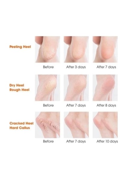 Silikon Topuk Nemlendirici Çorap fırsatları