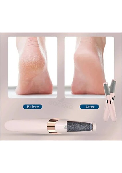 Şarjlı Ayak Tabanı Bakım Törpüsü Elektrikli Topuk Temizleme Makinası Nasır Sökücü fiyatları