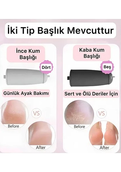 Şarjlı Ayak Tabanı Bakım Törpüsü Elektrikli Topuk Temizleme Makinası Nasır Sökücü modelleri