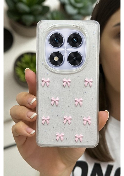 Xiaomi Note 14 Pro 4g Uyumlu Pembe Fiyonk Desenli Şeffaf Yumuşak Silikon Kılıf