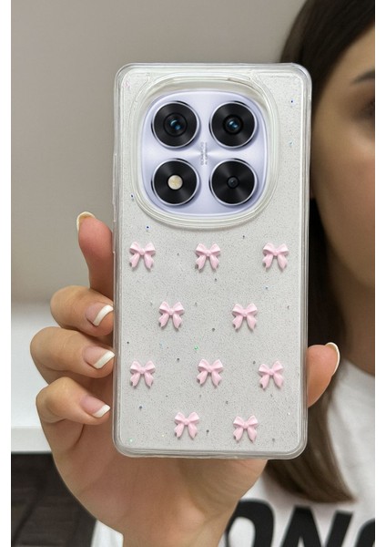 Xiaomi Note 14 Pro 4g Uyumlu Pembe Fiyonk Desenli Şeffaf Yumuşak Silikon Kılıf fiyatları