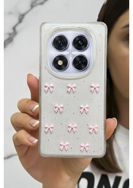 Xiaomi Note 14 Pro 4g Uyumlu Pembe Fiyonk Desenli Şeffaf Yumuşak Silikon Kılıf fırsatları