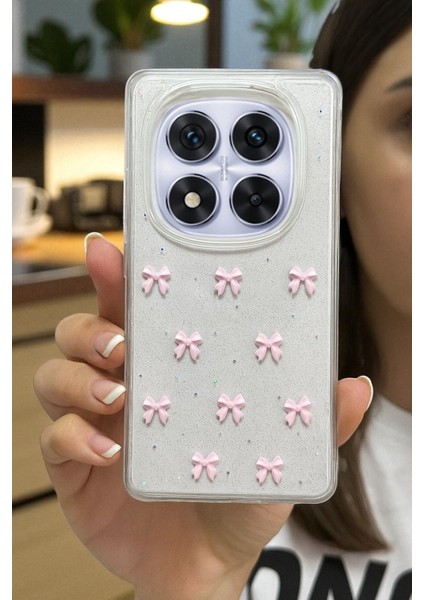 Xiaomi Note 14 Pro 4g Uyumlu Pembe Fiyonk Desenli Şeffaf Yumuşak Silikon Kılıf indirimleri