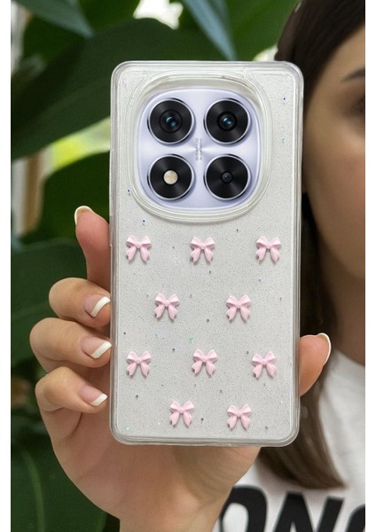 Xiaomi Note 14 Pro 4g Uyumlu Pembe Fiyonk Desenli Şeffaf Yumuşak Silikon Kılıf