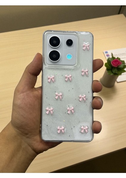 Xiaomi Note 13 Pro 4g Uyumlu Pembe Fiyonk Desenli Şeffaf Yumuşak Silikon Kılıf modelleri