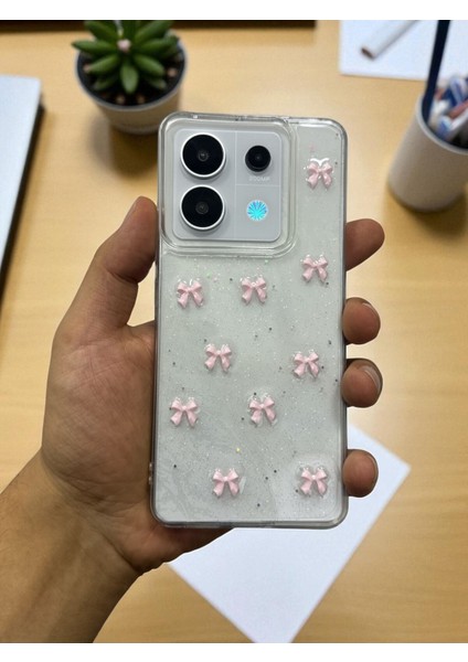 Xiaomi Note 13 Pro 4g Uyumlu Pembe Fiyonk Desenli Şeffaf Yumuşak Silikon Kılıf indirimleri