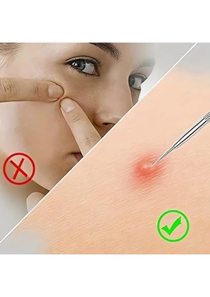 4'lü Kutulu Paslanmaz Çelik Komedon Akne Siyah Nokta Sivilce Siğil Temizleyici Çıkarıcı Seti Gümüş fiyatları