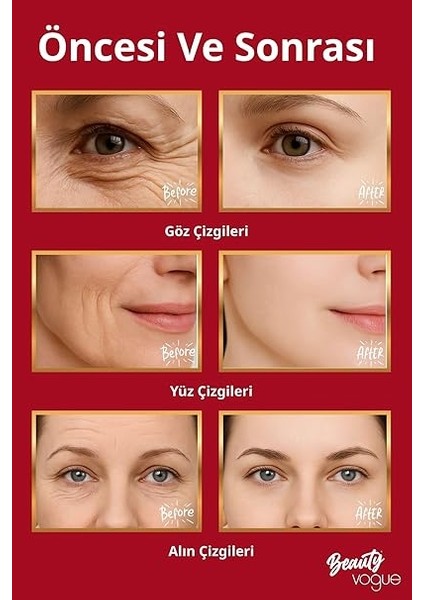 Yüz Sıkılaştırıcı Kırışıklık Giderme Aleti, Çift Çene Azaltıcı Titreşim Masajı Kırışıklıklar Görünüm Giderme ve Yüz Için Cilt Sıkılaştırma, Boyun modelleri