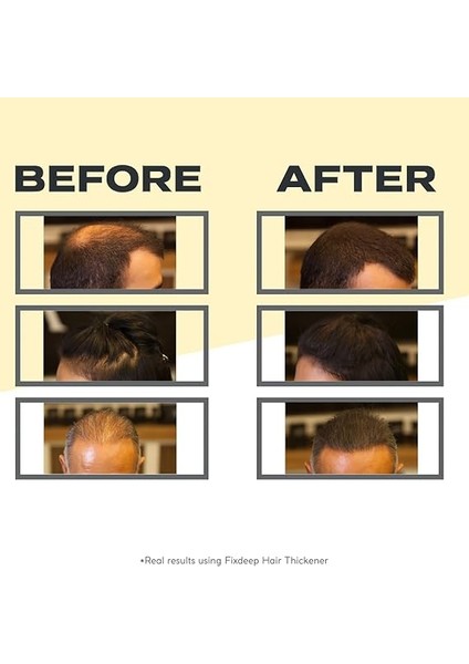 Yeni Nesil Saç Dolgunlaştırıcı Pudra 14 Gr. | Seyrek Saçlar Için Saç Fiberi | Fixdeep Suda Çıkmaz (Koyu Kahve) fiyatları