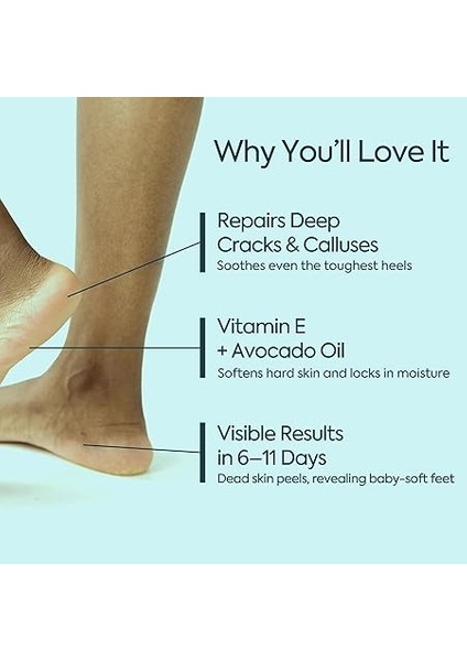 Topuk Çatlağı Kremi – Kuru ve Çatlamış Topuklar Için – E Vitamini ve Avokado Yağlı Topuk Kremi – Nasır, Sert ve Ölü Deriler Için Nemlendirici Ayak Bakım Kremi – 100 ml indirimleri
