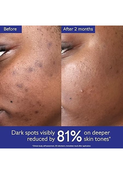 Vinoperfect Leke Karşıtı ve Işıltı Verici Serum 30 ml indirimleri