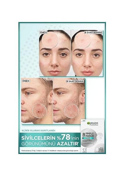 Pimple Patch 22'li Sivilce Bandı/hidrokolloid Bant indirimleri