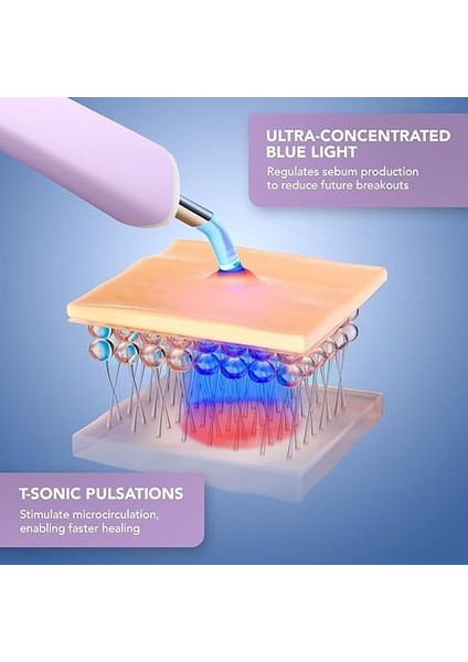 Espada 2 Plus Hassas Hedefleme Leke Karşıtı Cihaz - Leke Tedavisi Için Cilt Bakım Cihazı - Tıbbi Sınıf Silikon - Yüz Için Leke Tedavisi - Berrak Cilt fırsatları