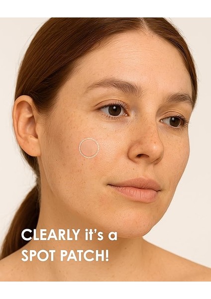 Clearly Spot Patch, Sivilce Karşıtı Şeffaf Plaster | Şeffaf, Ultra Ince, Hidrokolloid + Niacinamide + Salicylic Asit Içerikli Akne Karşıtı Yüz Bandı | 24 Adet fırsatları