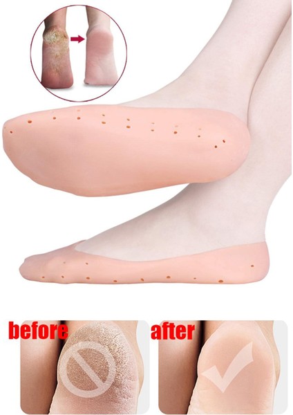 Topuk Çatlak Çorabı, Silikon Patik, Ayak Bakım Çorabı, Konforlu ve Sağlıklı