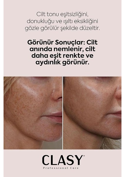 Pigment Düzeltici – Yüzdeki Lekeler Için Krem | Cilt Tonu Eşitleyici & Aydınlatıcı Krem | Koyu Halkalar ve Kızarıklıklar Için Renk Düzeltici – 100 ml indirimleri