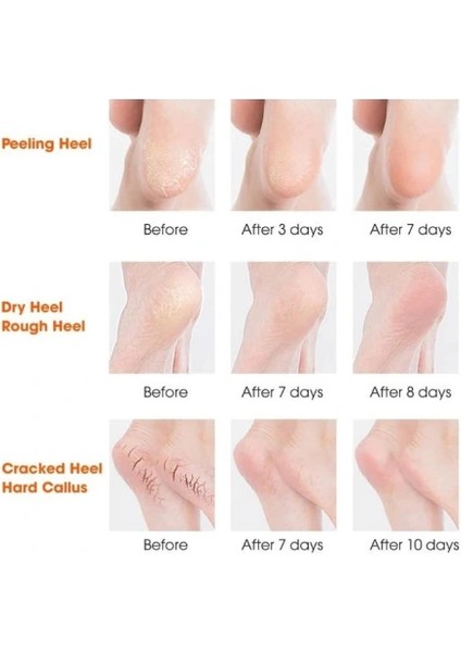 Buğz Silikon Topuk Nemlendirici Çorap modelleri