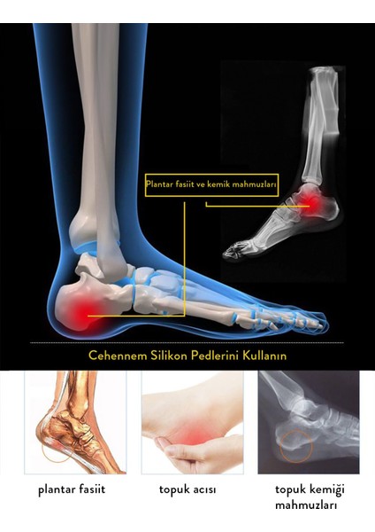 Ortopedik Medikal Silikon Tabanlık Topuk Dikeni Için Tabanlık Sihirli Jel Tabalığı