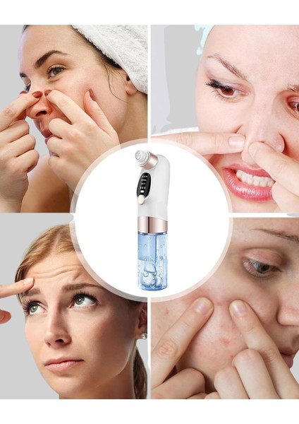 Çok Fonksiyonlu Cilt Bakım Cihazı – Siyah Nokta Gözenek ve Akne Temizleyici - UD001X-50OLL8 modelleri
