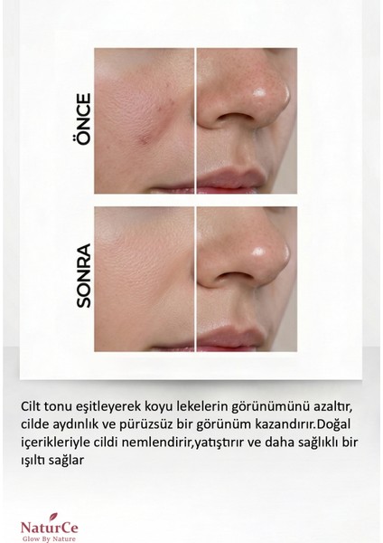 Aydınlatıcı C Vitamini & Ferulik Asit Serumu - Antioksidan Etkili