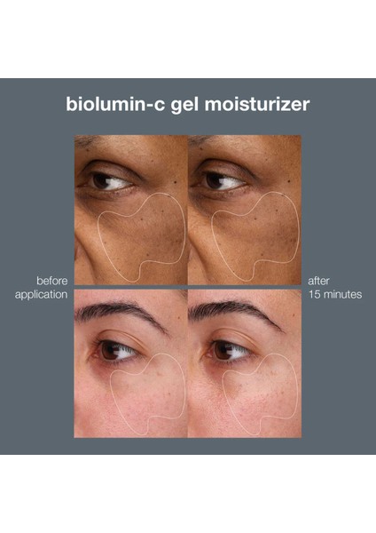 Biolumin-C Gel Moisturizer Günlük Aydınlatıcı ve Nemlendirici Jel-Krem 50 ml indirimleri