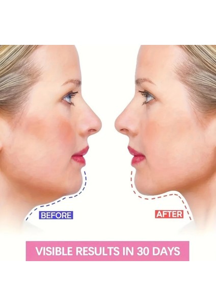 Ayarlanabilir V-Şekilli Yüz Kaldırma Bandı Unisex, Çift Çene ve Nazolabiyal Destek fiyatları