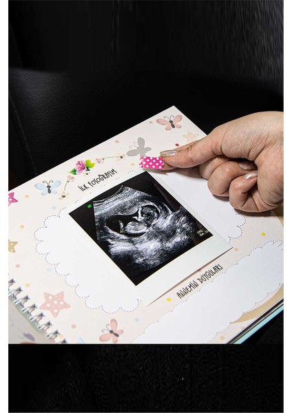 Hamilelik ve Anne Bebek Günlüğü - Sticker Hediyeli