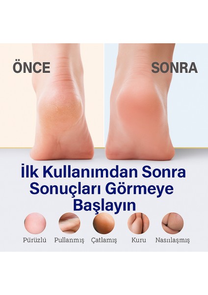 Silkia U.k Pedicare Çatlak Topuk Onarıcı Krem- 48 Saat Etkili Yoğun Bakım 35 ml modelleri