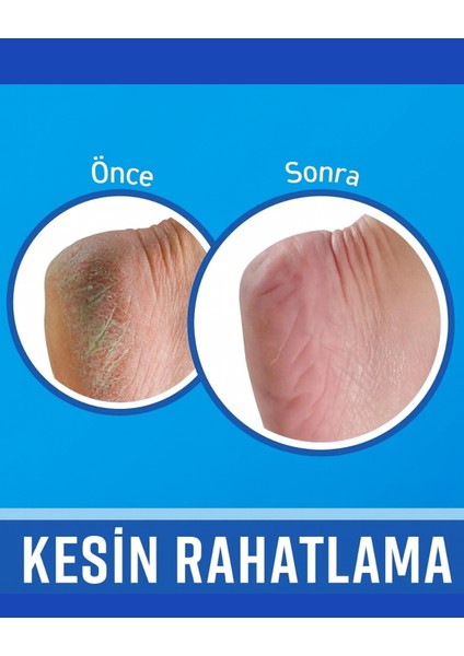 Silkia U.k Pedicare Çatlak Topuk Onarıcı Krem- 48 Saat Etkili Yoğun Bakım 35 ml fırsatları