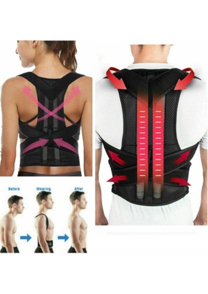 Dik Durmayı Destekleyen Sırt ve Omuz Korse Aparatı, Postür Düzeltici