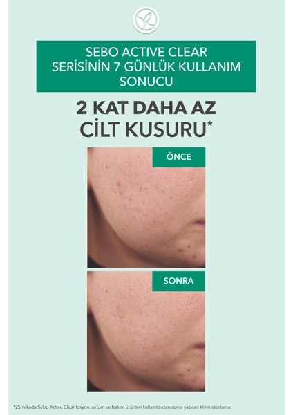 Gözenekleri Sıkılaştıran, Cildi Derinlemesine Arındırıp Yağ Dengesini Düzenleyen Tonik 150ML fırsatları