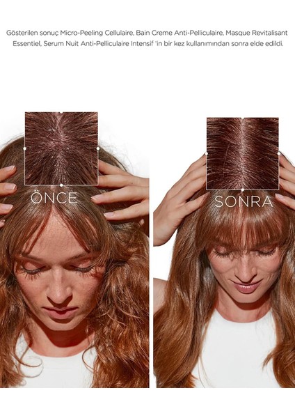 Symbiose Kepek Karşıtı Kurunsaç Derileri Için Nemlendirici Hücresel Şampuan 250 MLEVAKUAFOR2124566 modelleri