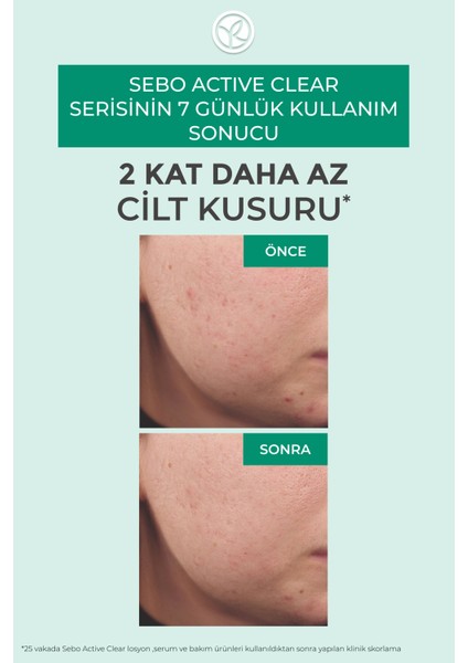 Akne ve Görünümünü Azaltmaya Yardımcı, Cildi Arındırıcı Bakım Kremi-Botanik KOMPLEKS-40ML fırsatları
