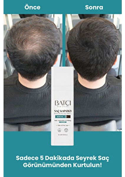 Batçı Hair Ateliler Batçı Hair Atelier Saç Kapatıcı 30 ml 2 Adet Sülfatsız Parabensiz Şampuan ile Kepek Karşıtı Etki modelleri