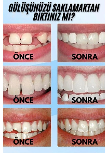 Parti Dişleri Yapım Malzemesi – Termoplastik Boncuklarla Cosplay, Kostüm ve Halloween Dişleri fırsatları