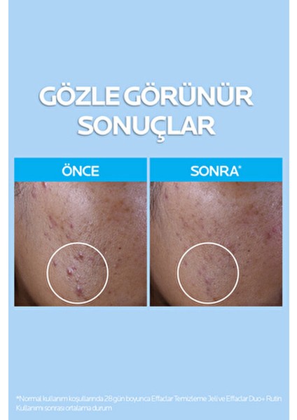 Yüz Bakım Seti: Effaclar Yüz Temizleme Jeli 50 ml, Tonik 200 ml ve Effaclar Duo+M Yağlı Ciltler İçin indirimleri