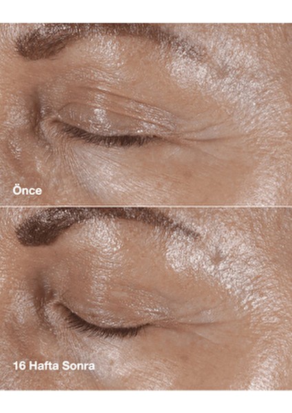 Smart Clinical Repair™ 15ml Çizgi ve Kırışıklık Görünümü Karşıtı Göz Kremi Tüm Cilt Tipleri İçin