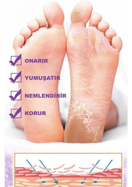 Ayak & Topuk Çatlak Kremi, Nasır Tedasivi, Ayak Kokusu Tedavisi, Nemlendirici 100 ml modelleri