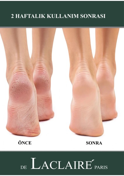 Ayak & Topuk Çatlak Kremi, Nasır Tedasivi, Ayak Kokusu Tedavisi, Nemlendirici 100 ml fırsatları