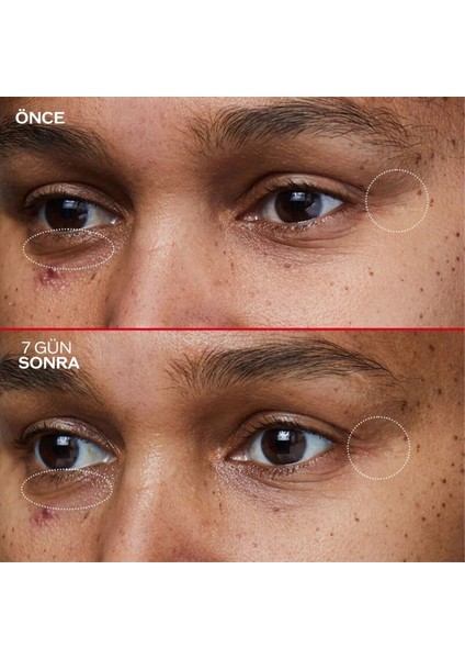 Benefıance Kırışıklık ve Yaşlanma Karşıtı Etkili Yenileme Formüllü Cilt Bakım Seti