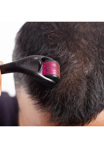 Derma Roller Titanyum Iğneli Cilt Bakım Aleti 1.00 mm fiyatları