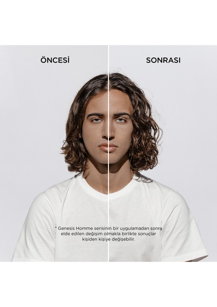 Genesis Homme Erkekler Için Saç Dökülme Karşıtı Güçlendirici Serum 90 ml fırsatları