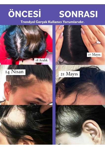 Anti Hair Loss Lotion 60ml