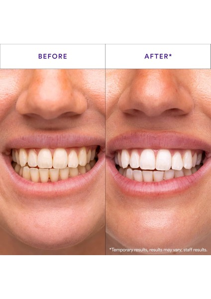 V34 Whitening Strips Diş Beyazlatma Bantları 14 Ughulama fiyatları