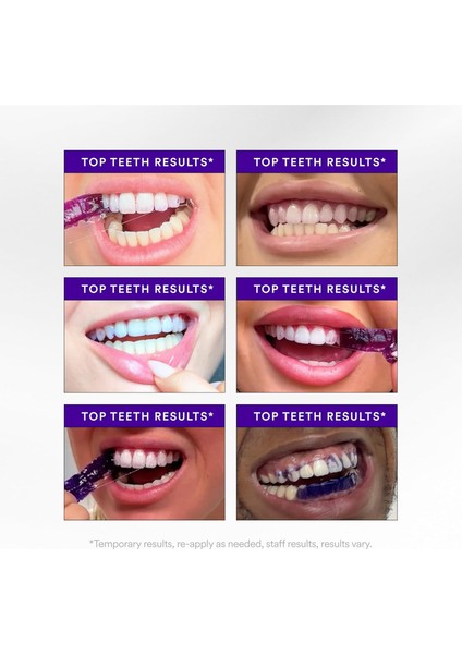 V34 Whitening Strips Diş Beyazlatma Bantları 14 Ughulama modelleri