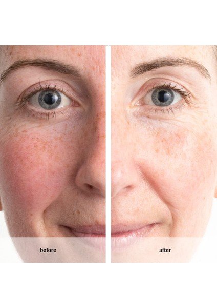 Avon Anew Renewal Power Serum 30 Ml. modelleri