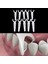Nude Tarzı Diş Ipi Interdental Fırça Diş Çubuğu Kürdan Diş Ipliği Flok Sıcak Satış (Yurt Dışından) 4