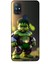 Oneplus Nord N10 5g Kılıf Caliburn 24 Hulk Bebek Darbe Emici Kılıf 1